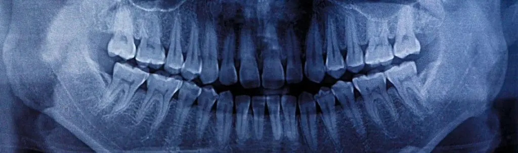 Artificial Intelligence in&nbsp;dental health care &ndash; a&nbsp;case study