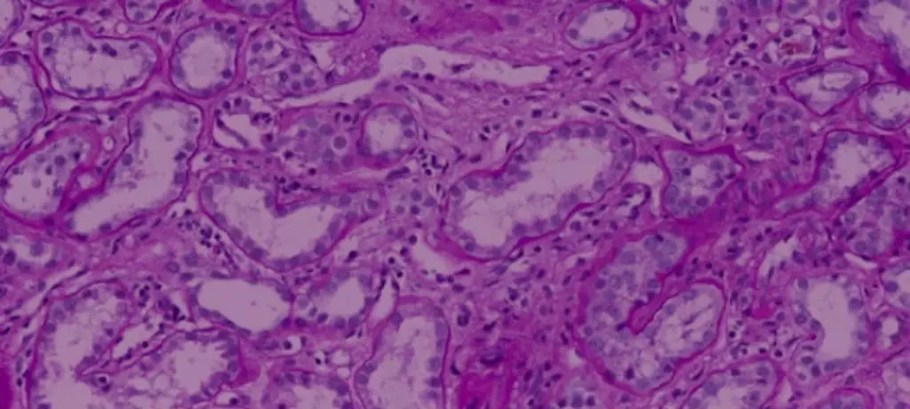 deepsense.ai again among the leaders in&nbsp;the Kaggle competition